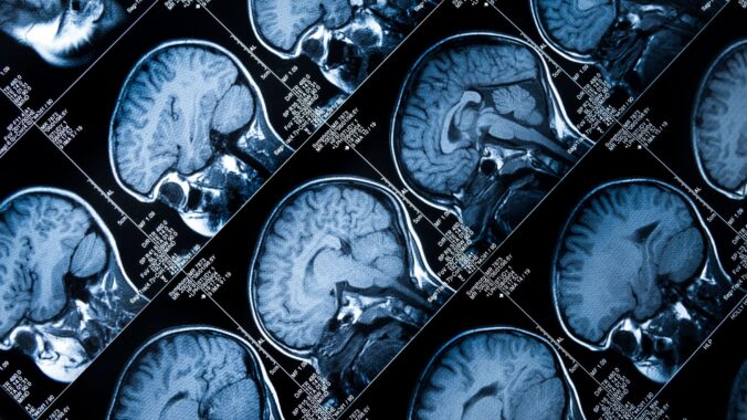 Concussion Litigation: What Neuroscience Tells Us About Brain Injuries